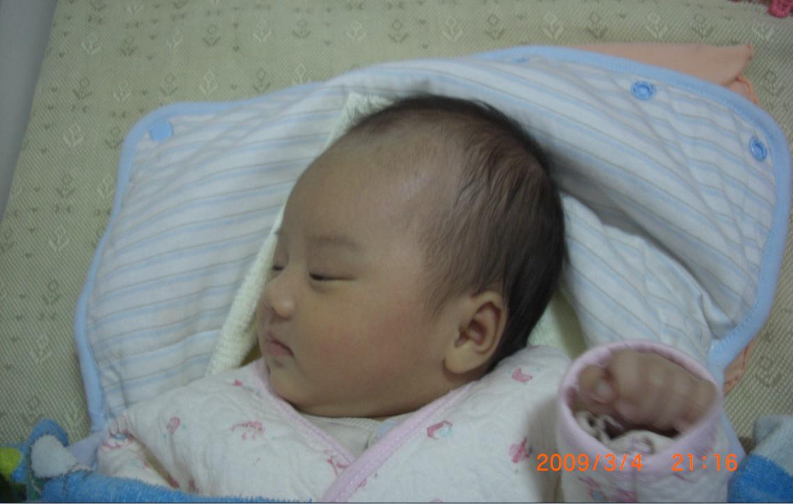 婴儿头型正常图_幼儿喂养一朋友说宝宝的头型看着不正常各位