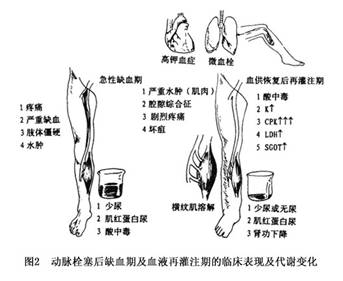 关于代谢综合征:代谢性疾病的前兆的专升本毕业论文范文